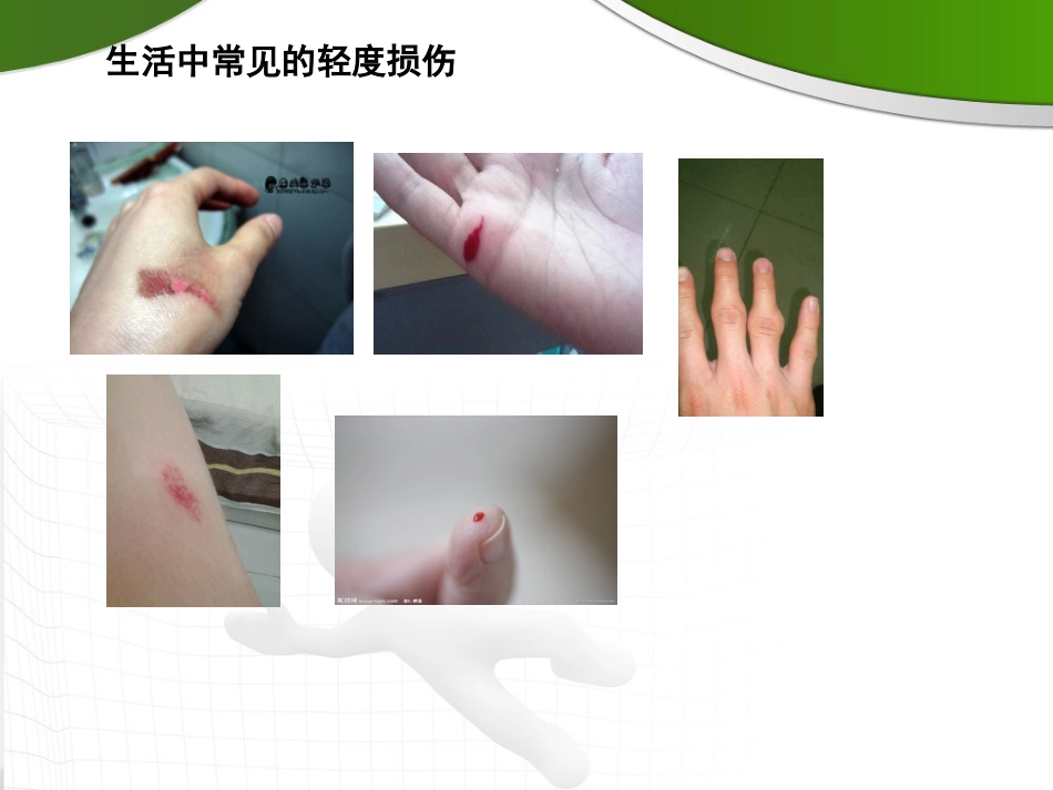 体育与健康（5-6年级）第3节《轻度损伤的自我处理》ppt课件1.pptx_第3页